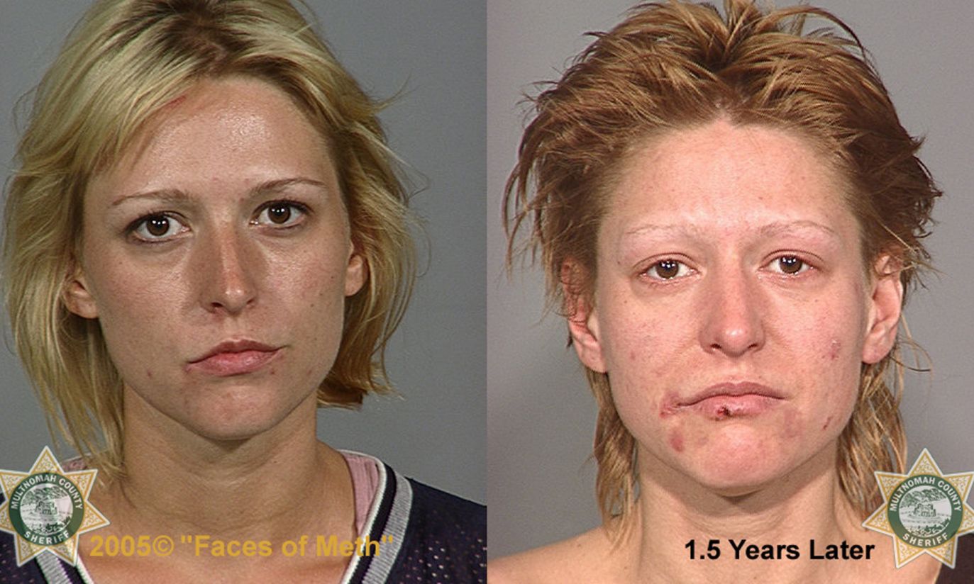 10 years younger before and after pictures 10 years younger before and after pictures