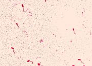 Изображение группы бактерий Vibrio cholerae. 14 сентября 2000 года. Фото: Center For Disease Control / Zuma Press / Forum