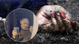 This photo of Iryna Filkina's hand went viral, symbolizing the brutality inflicted on Bucha. Photo: X/Euromaidan Press