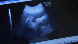 W Polsce aborcja jest  możliwa, gdy ciąża stanowi zagrożenie dla życia lub zdrowia kobiety lub gdy powstała w wyniku czynu zabronionego (fot. TVP)